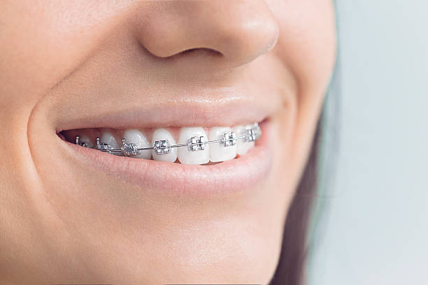 Trusted Hanover, OH Holistic Dental Care Services Experts